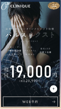 いびきレーザー治療